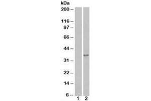 Western blot testing of HEK293 cell lysate overexpressing DOK5 with DOK5 antibody [mock transfection in lane 1]. (DOK5 抗体)