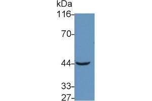 Detection of TNFRSF19L in Mouse Skeletal muscle lysate using Polyclonal Antibody to Tumor Necrosis Factor Receptor Superfamily, Member 19 Like Protein (TNFRSF19L) (TNFRSF19 抗体  (AA 41-161))
