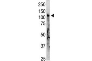 Western Blotting (WB) image for anti-2'-5' Oligoadenylate Synthetase 3 (OAS3) antibody (ABIN3002560) (OAS3 抗体)