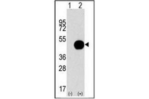 Western blot analysis of APG4B (arrow) using APG4B / ATG4B Antibody . (ATG4B 抗体  (AA 264-293))