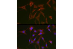 Immunofluorescence (IF) image for anti-Signal Transducer and Activator of Transcription 5A (STAT5A) (AA 635-794) antibody (ABIN6148576)