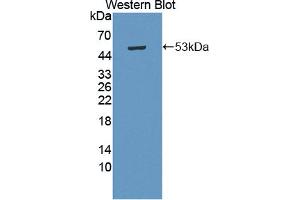 Western blot analysis of the recombinant protein. (CHRDL1 抗体  (AA 22-450))