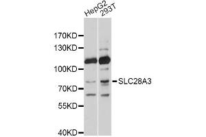 Western blot analysis of extracts of various cell lines, using SLC28A3 antibody. (SLC28A3 抗体)