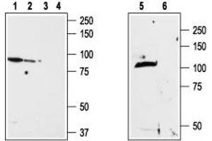 Western blot analysis of ND7/23 cell line membrane (lanes 1 and 3), RBL lysates (lanes 2 and 4) and rat brain membrane (lanes 5and 6): - 1,2,5. (TRPV2 抗体  (1st Extracellular Loop))