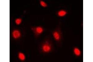 Immunofluorescent analysis of Dyskerin staining in MCF7 cells. (DKC1 抗体)