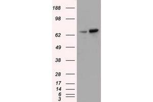 Western Blotting (WB) image for anti-Sorting Nexin 9 (SNX9) antibody (ABIN1501046)