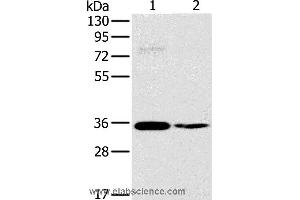 Western blot analysis of 293T and skov3 cell, using OTUB1 Polyclonal Antibody at dilution of 1:570 (OTUB1 抗体)