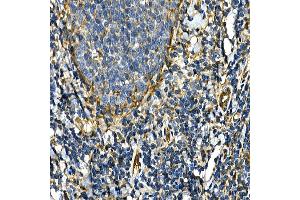 Immunohistochemistry of paraffin-embedded human tonsil using [KO Validated] Integrin alpha 2 (ITG/CD49b) Rabbit pAb (ABIN6133345, ABIN6142558, ABIN6142559 and ABIN7101812) at dilution of 1:50 (40x lens). (ITGA2 抗体)