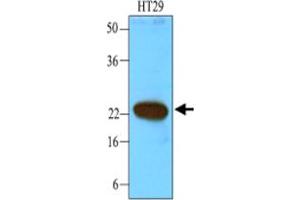 Western blot analysis of cell lysates of HT-29 (40 ug) were resolved by SDS - PAGE , transferred to NC membrane and probed with CIB1 monoclonal antibody , clone 1D1 (1 : 1000) . (CIB1 抗体)