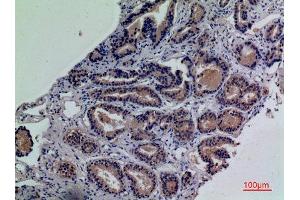 Immunohistochemistry (IHC) image for anti-Ectonucleotide pyrophosphatase/phosphodiesterase 3 (ENPP3) (Internal Region) antibody (ABIN3187797)