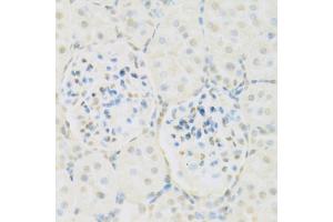 Immunohistochemistry of paraffin-embedded rat kidney using KAT2A antibody. (KAT2A 抗体)