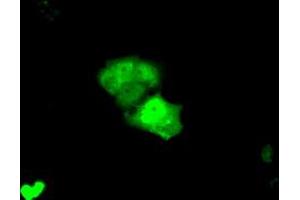 Anti-KHK mouse monoclonal antibody (ABIN2453194) immunofluorescent staining of COS7 cells transiently transfected by pCMV6-ENTRY KHK (RC202424). (Ketohexokinase 抗体)