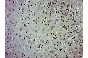 Paraformaldehyde-fixed, paraffin embedded mouse brain; Antigen retrieval by boiling in sodium citrate buffer (pH6. (TrkA, B, C (pTyr516) 抗体)
