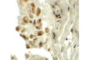 Immunohistochemistry (IHC) image for anti-tRNA-YW Synthesizing Protein 1 Homolog (TYW1) (C-Term) antibody (ABIN1030788) (TYW1 抗体  (C-Term))