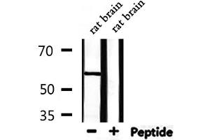 Western blot analysis of extracts from rat brain, using USP30 Antibody. (Usp30 抗体  (N-Term))