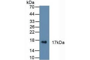 Detection of CST6 in Human Urine using Polyclonal Antibody to Cystatin 6 (CST6) (CST6 抗体  (AA 29-149))