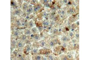 Used in DAB staining on fromalin fixed paraffin-embedded Liver tissue (GDF2 抗体  (AA 22-178))