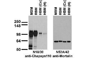 Immunoblot against crude membranes from whole adult mouse brain (MBM) or rat brain (RBM) and from human cerebral cortex [HBM(Cx)] or hippocampus [HBM(H)] probed with N18/30 (left) or N52A/42 (right) TC supe. (DLG2 抗体  (AA 1-852))