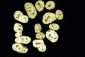 Immunofluorescence staining of SK-N-MC (Human neuroblastoma, ATCC HTB-10). (CTBP2 抗体  (AA 361-445))
