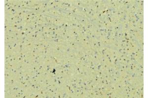 ABIN6272908 at 1/100 staining Mouse brain tissue by IHC-P. (UBAP1 抗体)