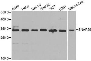 Western blot analysis of extracts of Jurkat cell line, using SNAP29 antibody. (SNAP29 抗体  (AA 1-258))