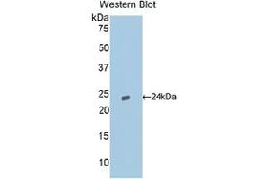 Western blot analysis of the recombinant protein. (Caspase 9 抗体  (AA 1-200))