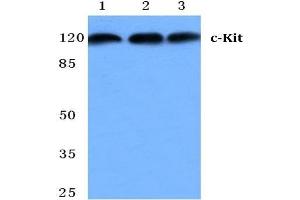 Western blot analysis of CD117/c-Kit antibody at 1/500 dilution in: Lane 1: MCF-7 cell lysate. (KIT 抗体)