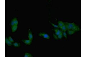 Immunofluorescent analysis of Hela cells using ABIN7145700 at dilution of 1:100 and Alexa Fluor 488-congugated AffiniPure Goat Anti-Rabbit IgG(H+L) (BMP7 抗体  (AA 293-431))