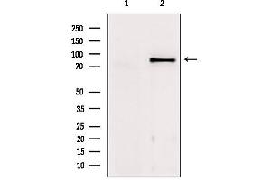 Western blot analysis of extracts from mouse brain, using TACC1 Antibody. (TACC1 抗体  (N-Term))