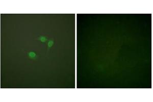 Immunofluorescence analysis of NIH/3T3 cells, using Sumo1 antibody. (SUMO1 抗体  (N-Term))