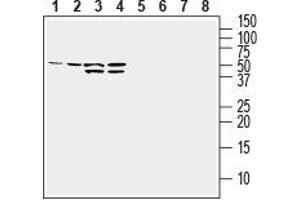 Western blot analysis of human MDA-MB-231 breast adenocarcinoma cell line lysate (lanes 1 and 5), human HepG2 hepatocellular carcinoma cell line lysate (lanes 2 and 6), human K562 chronic myeloid leukemia cell line lysate (lanes 3 and 7) and human Jurkat T-cell leukemia cell line lysate (lanes 4 and 8): - 1-4. (GLUT1 抗体  (Extracellular))