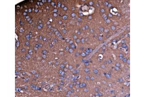 IHC analysis of NEAS/SPTAN1 using anti-NEAS/SPTAN1 antibody (ABIN7600436).