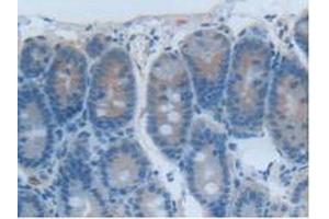 Detection of CEACAM1 in Rat Intestine Tissue using Polyclonal Antibody to Carcinoembryonic Antigen Related Cell Adhesion Molecule 1 (CEACAM1) (CEACAM1 抗体  (AA 36-145))