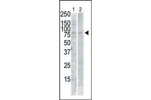 Western Blotting (WB) image for anti-Polo-Like Kinase 2 (PLK2) (AA 375-406), (C-Term) antibody (ABIN391375)