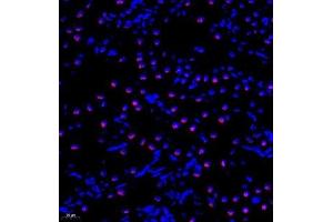 Immunofluorescence analysis of paraffin embedded rat kidney using TIP49A (ABIN7075488) at dilution of 1: 300 (RUVBL1 抗体)