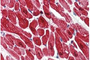 Human Heart (formalin-fixed, paraffin-embedded) stained with TNNI3 antibody ABIN334276 at 2. (TNNI3 抗体)