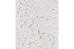 Immunohistochemistry (Paraffin-embedded Sections) (IHC (p)) image for anti-Triggering Receptor Expressed On Myeloid Cells 2 (TREM2) (AA 22-48), (N-Term) antibody (ABIN1539189)