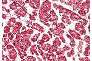 Immunohistochemistry (IHC) image for anti-Eukaryotic Translation Initiation Factor 4H (EIF4H) (C-Term) antibody (ABIN2776553)