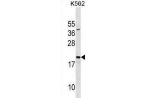 Western Blotting (WB) image for anti-Activated RNA Polymerase II Transcriptional Coactivator p15 (SUB1) antibody (ABIN3001149) (SUB1 抗体)