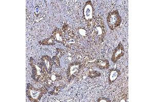 IHC analysis of TRMT2B using anti-TRMT2B antibody (ABIN7599456).