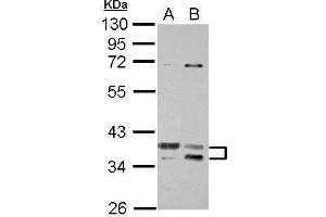 WB Image Sample (30 ug of whole cell lysate) A: Jurkat B: K562 10% SDS PAGE antibody diluted at 1:1000 (TSFM 抗体)
