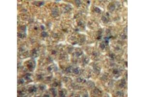 #VALUE! (ITIH2 抗体  (AA 452-702))