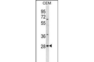 ALKBH4 Antibody (Center) (ABIN656701 and ABIN2845934) western blot analysis in CEM cell line lysates (35 μg/lane). (ALKBH4 抗体  (AA 88-117))