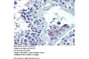 Immunohistochemistry with Human Testis lysate tissue at an antibody concentration of 5. (ASH2L 抗体  (Middle Region))