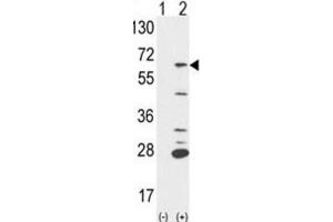 Western Blotting (WB) image for anti-Protein-tyrosine Phosphatase 1C (PTPN6) antibody (ABIN5021218) (SHP1 抗体)