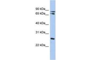 Image no. 1 for anti-Ovo-Like 2 (OVOL2) (C-Term) antibody (ABIN6742352) (OVOL2 抗体  (C-Term))