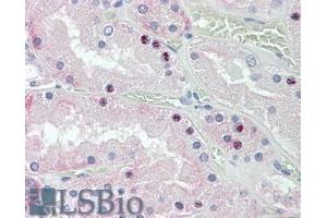 ABIN308427 (3. (HOXD10 抗体  (Internal Region))