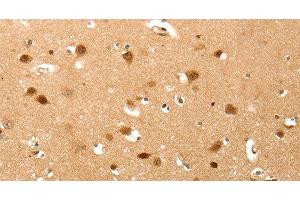 Immunohistochemistry of paraffin-embedded Human brain tissue using TNN Polyclonal Antibody at dilution 1:40 (Tenascin N 抗体)