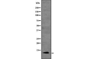 Western blot analysis of CCL20 expression in HEK293 cells ,The lane on the left is treated with the antigen-specific peptide. (CCL20 抗体  (Internal Region))
