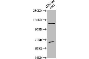Western Blot Positive WB detected in: Glycine max leaf tissue All lanes: CESA4 antibody at 1:500 Secondary Goat polyclonal to rabbit IgG at 1/50000 dilution Predicted band size: 120 kDa Observed band size: 120 kDa (CESA4 抗体  (Catalytic Subunit 4))
